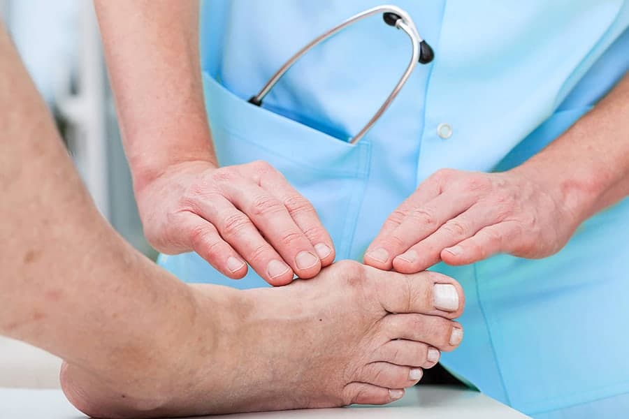 Quand remarcher après une opération de hallux valgus ?