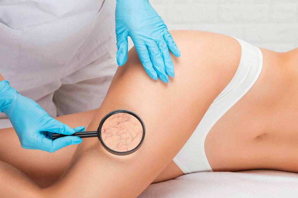 Un dermatologue peut-il pratiquer la sclérothérapie ?